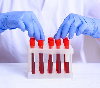 Blood Samples