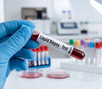 Liquid Biopsy
