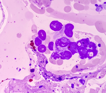 Peripheral Blood