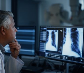 Monitoring Selected Lung Nodules