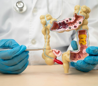 Detecting Abnormalities
