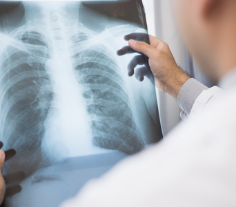 Assessing the Chest