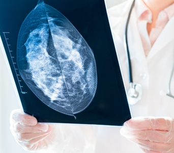 Assessing Cancer-Related Complications