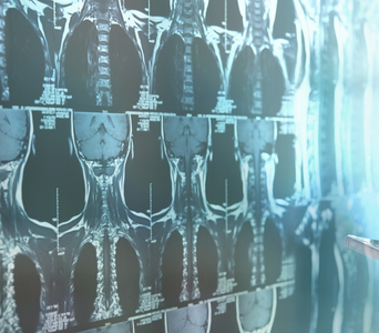 Thyroid Cancer Imaging