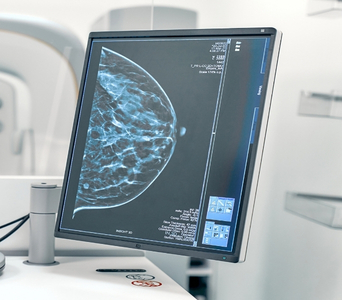Breast Cancer Screening