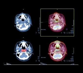 Identifying a Suitable Biopsy Site