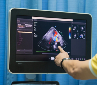 Supporting Cancer Diagnosis