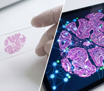 Disease Characterisation