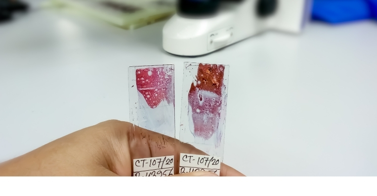 Cytopathology