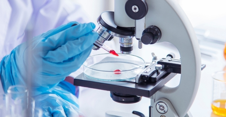 Immunohistochemistry