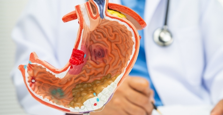 Upper GI Endoscopy