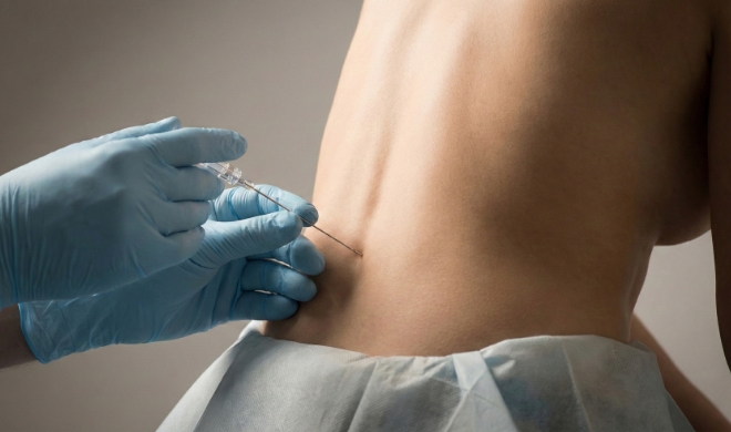 During the Procedure