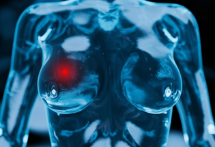 Mammography-Guided Localisation