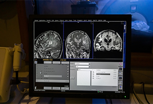 MRI-Guided Localisation