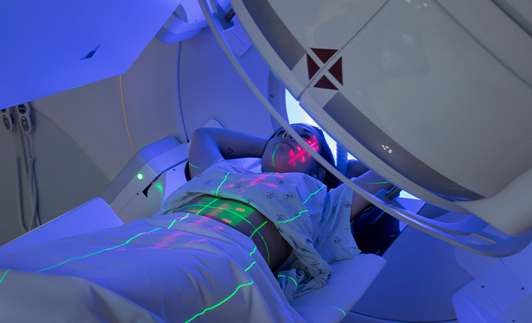 Intensity-Modulated Radiation Therapy