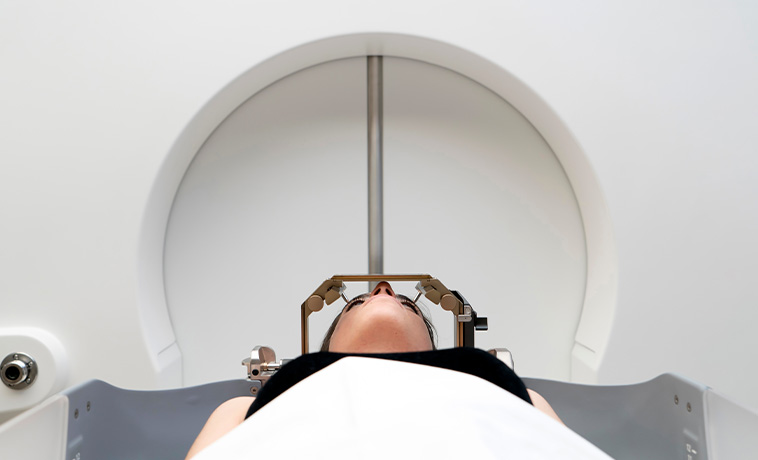 CyberKnife Radiosurgery