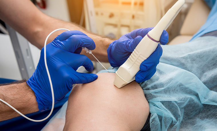 Radiofrequency Ablation