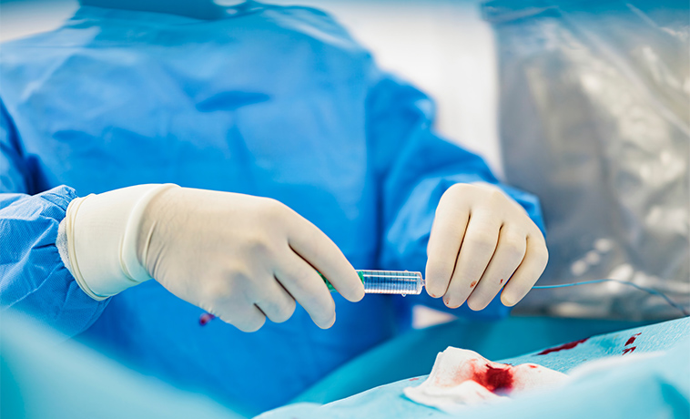 Embolisation Therapy