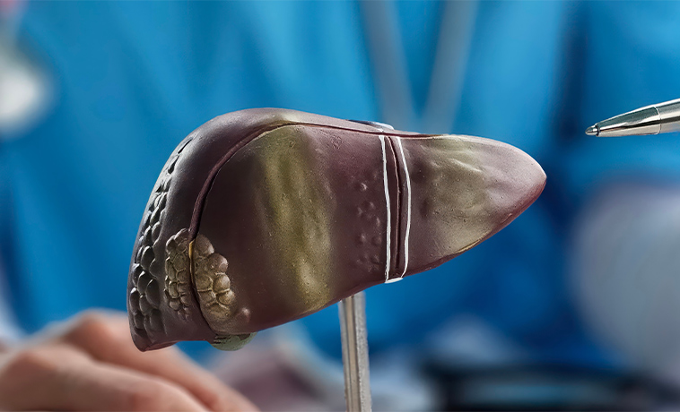 Radioembolisation
