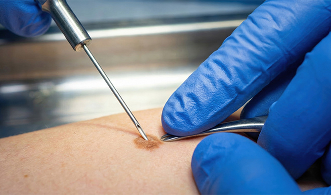 Organ-Preserving and Function-Sparing Surgery